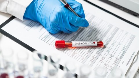 Operativ Qərargahdan koronavirus AÇIQLAMASI