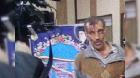 Səfirliyimizə hücum edən terrorçunun FOTOSU