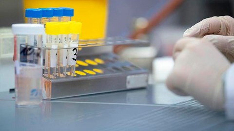 Pakistanda meymunçiçəyinə ilk yoluxma aşkarlandı