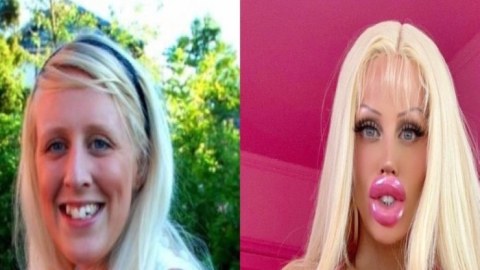 Özünü "Barbi"yə oxşatmaq üçün 130 min dollar xərclədi