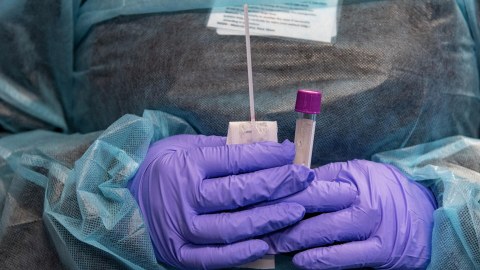 Azərbaycanda koronavirusun yeni ştamı AŞKARLANIB?