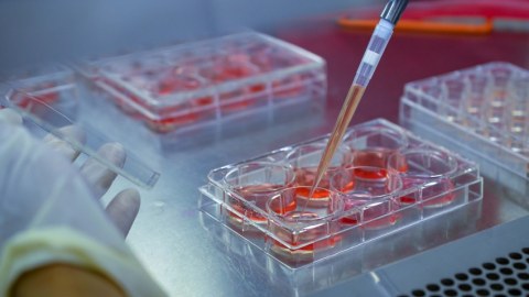 Xərçəng xəstəliyi üçün yeni bioloji preparat yaradıldı