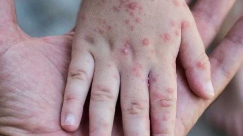 Qızılcadan ölən 3 yaşlı Rüfətin atası: Oğlum bağçadan başqa heç yerə getmirdi - FOTO