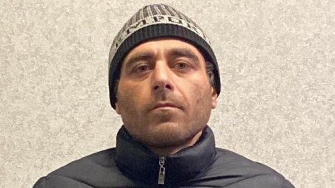 Stomatoloji kabinetdən 9 qızıl diş OĞURLANDI