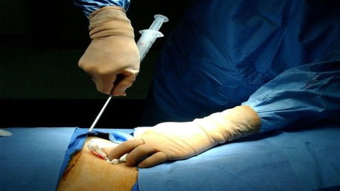 Yeni Klinikada sümük iliyi transplantasiyası həyata keçiriləcək