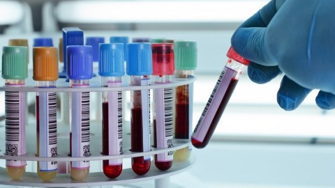 Bakının 2 qəsəbəsində hepatit virusu YAYILDI