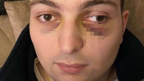 Ticarət mərkəzində döyülən oğlanla bağlı araşdırma BAŞLADI