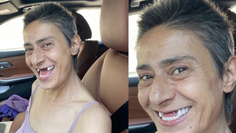 Sosial mediada dişsiz şəklini paylaşdı - FOTO