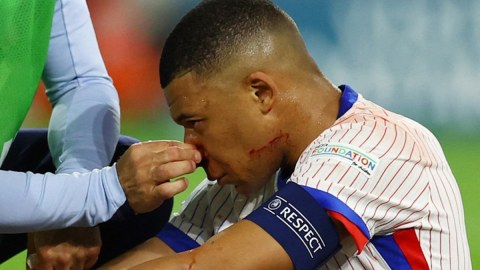 Mbappe Avropa Çempionatının oyunlarını buraxacaq - Burnu sındı