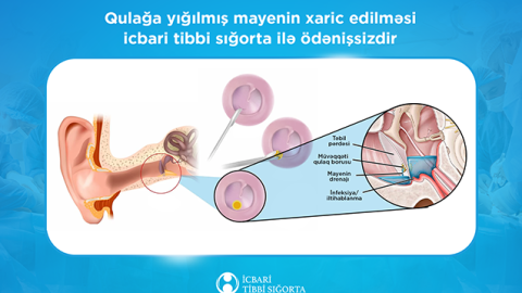 İcbari tibbi sığorta bu əməliyyatı da qarşılayır
