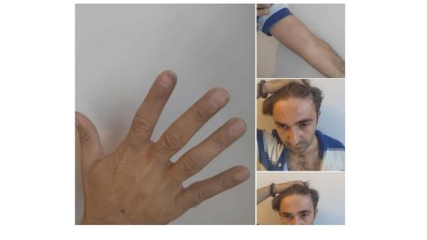 Deputatlığa namizədin vəkilinə zorakılıqla bağlı araşdırma aparılır
