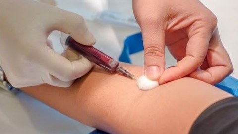 Alimlər yeni qan qrupu kəşf ediblər - MAL adlanır