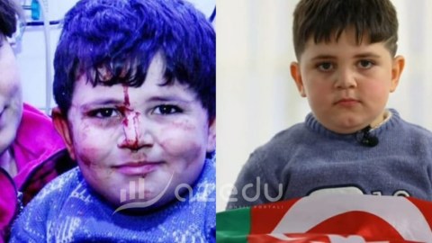 Gəncə terrorunun balaca qurbanı: "Polad Həşimov kimi olmaq istəyirəm"&nbsp;