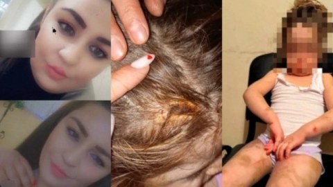 Azyaşlı qızına işgəncə verən ana ilə bağlı HƏBS QƏRARI