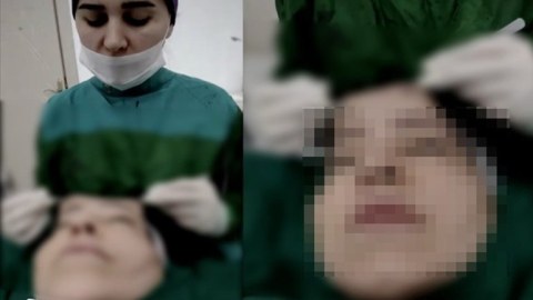 Həkim üzgərmə əməliyyatında canlı yayım açdı - Araşdırma BAŞLADI