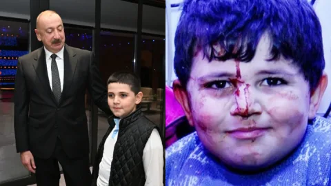 Gəncə terrorunun canlı şahidi - Bəxtiyar - FOTOLAR