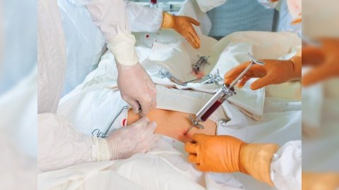 Sümük iliyi köçürməsi&nbsp;tibbi sığorta ilə mümkün olacaq