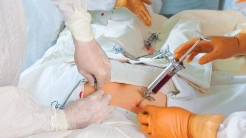 Sümük iliyinin transplantasiyasını həyata keçirən xəstəxanaların sayı ARTIRILDI