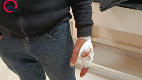Şəkidə canavar kəndə hücum etdi - Xəsarət alanlar var