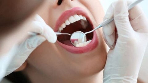 Azərbaycanda 74 stomatoloq qanunsuz fəaliyyət göstərirmiş
