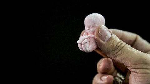 Azərbaycanda abortların sayı rekord həddə çatıb