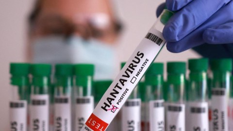 Daha bir nəfərdə hantavirus aşkarlandı