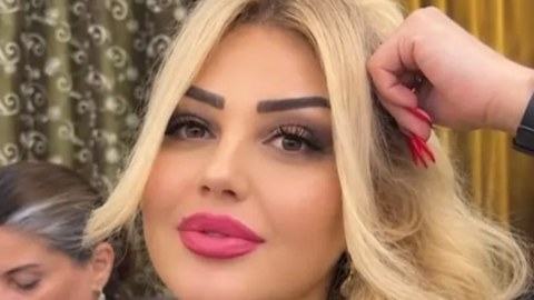 Bakıda dişini çəkdirən qadın vəfat etdi - GÖRÜNTÜ
