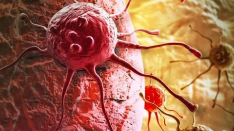 Tanınmış həkim xərçəngin səbəblərin açıqladı