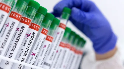 Последняя ситуация с оспой обезьян в Азербайджане объявлена