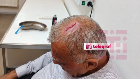 İcra nümayəndəsi bələdiyyə sədrinin başına butulka çırpıb - FOTO