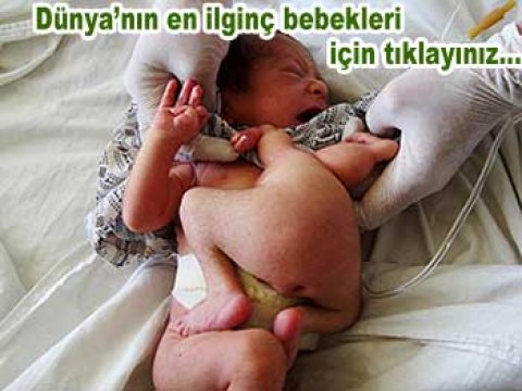 Bir neçə gün başsız yaşayan körpə...