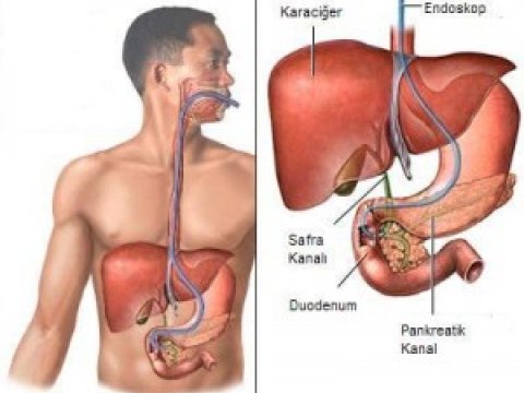 Azərbaycanda “sarılıq” xəstəliyinin statistikası düzgün aparılırmı?