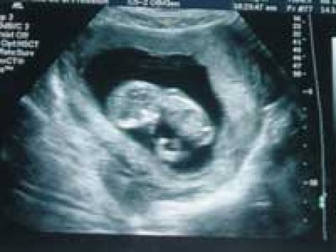 Ədliyyə Nazirliyinin baş idarə rəisi: "Qeyri-rəsmi nikahdan doğulan uşaqların sayı artıb"