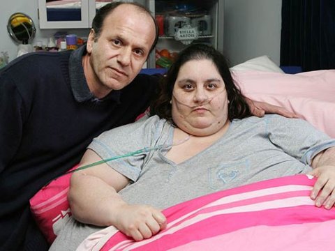 40 yaşında 285 kilo olan qadın dünyasını dəyişib