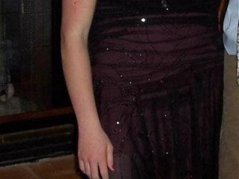 “Siam əkizi” olan baclar ərə getməyi arzulayırlar