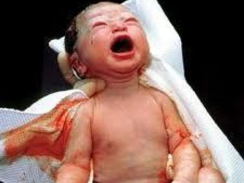 Azərbaycanda gündə 440 körpə doğulur