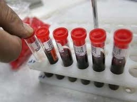 Mərkəzi Qan Bankı Azərbaycanda ən az tapılan qan rezuslarını açıqlayıb