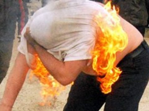 “Özünüzü yandırmayın” - Qarabağ qaziləri cəbhə yoldaşlarına müraciət etdi