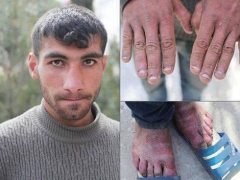 19 May tarixinin məlum və naməlum qəhrəmanları - FOTOLAR