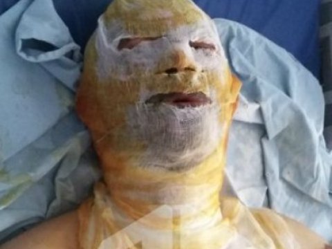  Borca görə bankın qarşısında özünü yandıran şəxsdən yeni xəbər 