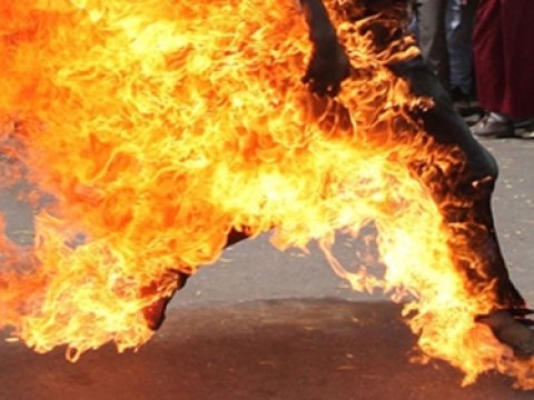 Borca görə özünü yandıran kişinin vəziyyəti ağırdır - AÇIQLAMA