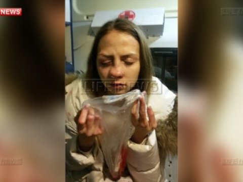 Xanım jurnalist pərəstişkarı tərəfindən ölümcül döyüldü - FOTO