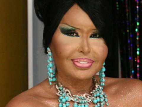 Bülent Ersoy “donuz qripi”nə yoluxub