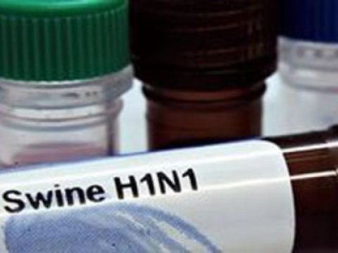 Ermənistanda 4 nəfər “donuz qripi”ndən ölüb