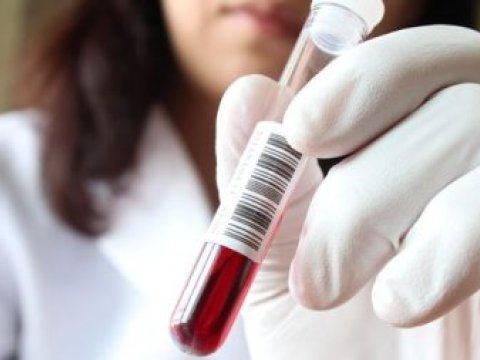 Türkiyədə daha bir nəfər “donuz qripi”ndən öldü 