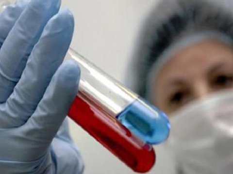 Ermənistanda “donuz qripi”ndən daha bir nəfər öldü 