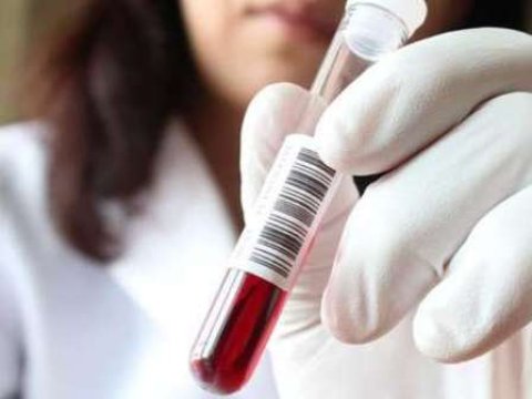  Azərbaycanda “donuz qripi“ ilə bağlı palata yaradıldı 