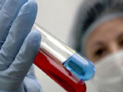 Azərbaycanda “donuz qripi” şübhəsi ilə 80 nəfərdən analiz götürülüb 