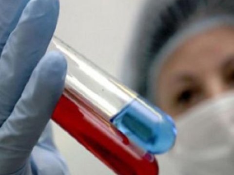 Gömrük komitəsi “donuz qripi” ilə bağlı məlumat yaydı 