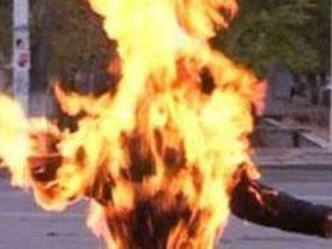 Bakı sakini özünü yandırdı 